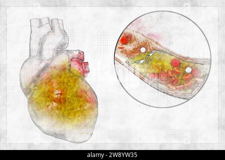 Obese heart, illustration Stock Photo