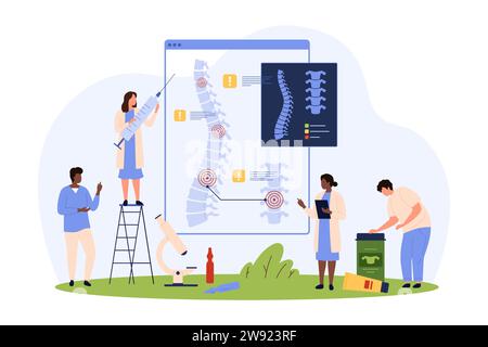 Diagnosis and treatment of chronic spinal diseases vector illustration. Cartoon tiny people check xray of spine for problem vertebrae, therapy for inf Stock Vector