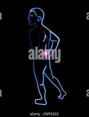 Vector isolated illustration of a man with lower back pain. Neon outline drawing of a person with back pain. Symptoms of osteochondrosis. A patient wi Stock Vector