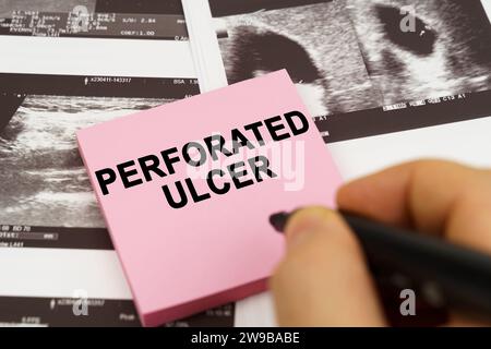 Medical concept. On the ultrasound pictures there are stickers that say - Perforated ulcer Stock Photo