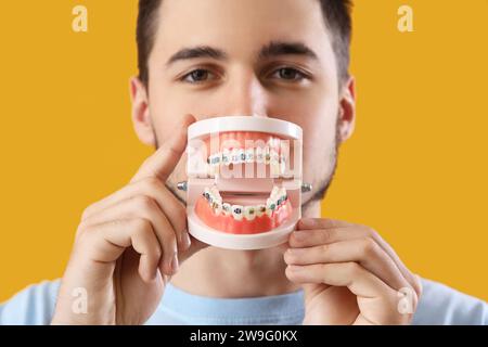 Handsome young man holding model of jaw with dental braces on yellow background. Dental care concept Stock Photo