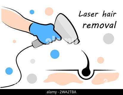 Laser hair removal. Hair accent. Doodle Stock Vector