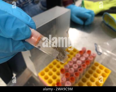 PRODUCTION - 29 November 2023, Zurich, Zürich: A frozen stool sample in a jar. Swiss scientists want to create a vault for intestinal bacteria from all over the world. (to dpa 'A vault for human feces: project aims to save gut bacteria') Photo: Christiane Oelrich/dpa Stock Photo