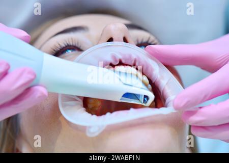 Orthodontist scaning patient with dental intraoral 3d  scanner. Modern dental clinic with equipment. Prosthodontics And Stomatology Concept. Close Up Stock Photo