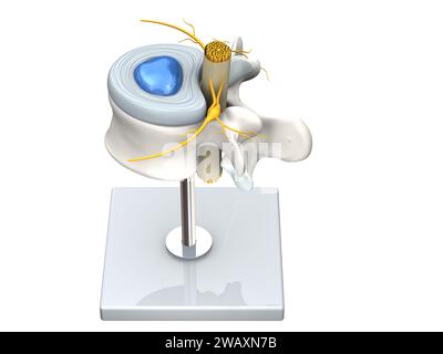 Illustration showing model of a healthy lumbar vertebra with disc and ...