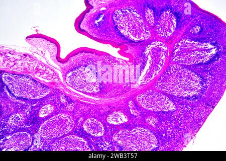 Human palatine tonsil section showing circular lymphoid follicles and secretory gland. Light micrograph, haematoxylin eosin stain. X30 when printed 10 Stock Photo