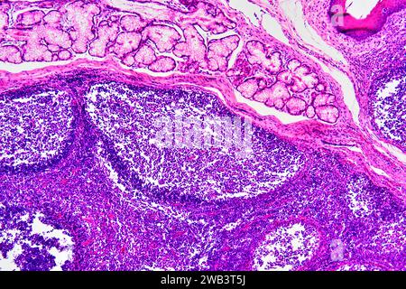 Human palatine tonsil section showing circular lymphoid follicles and secretory gland. Light micrograph, haematoxylin eosin stain. X75 when printed 10 Stock Photo