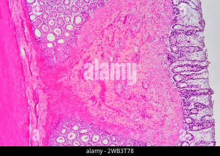 Human vermiform appendix cross section showing (left to right), muscular circular layer, submucosal layer and mucosal layer with Lieberkuhn crypts and Stock Photo