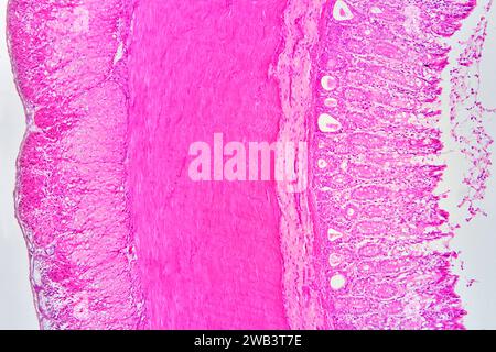 Human vermiform appendix cross section showing (left to right) adventitious layer, serous layer, muscular longitudinal layer, muscular circular layer, Stock Photo