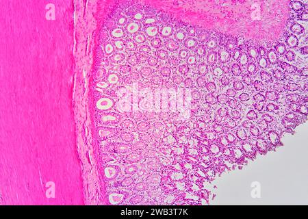 Human vermiform appendix cross section showing (left to right), muscular circular layer, submucosal layer and mucosal layer with Lieberkuhn crypts. Li Stock Photo