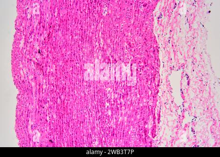 Human artery cross section showing tunica externa, tunica media with smooth muscle fibers and tunica intima. X75 at 10 cm wide. Stock Photo