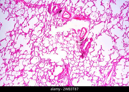 Human lung section showing alveoli, bronchiole and blood vessels. X30 at 10 cm wide. Stock Photo