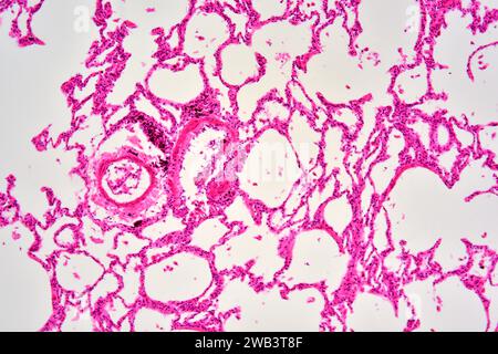 Human lung section showing alveoli, bronchiole and blood vessels. X75 at 10 cm wide. Stock Photo