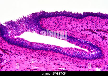 Human transitional epithelium and smooth muscle tissue. X125 at 10 cm ...