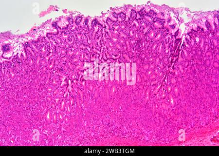 Cross section of human stomach. Light micrograph showing stomach ...