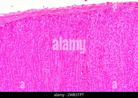 Human adrenal gland section showing from top to bottom: fibrous capsule, zona glomerulosa and zona fasciculata. Human adrenal gland or suprarenal glan Stock Photo