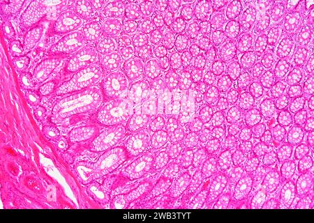 Large Intestinal Crypts Human large intestine, light micrograph Stock Photo - Alamy