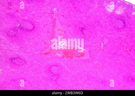 Human spleen (lymphatic organ) showing capsules, red pulp, white pulp ...