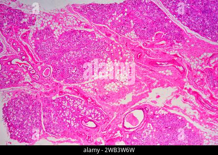 Human umbilical cord mucosa showing: mucous glands, loose conective tissue, adipocytes, smooth muscle fibers and blood vessels. X25 at 10 cm wide. Stock Photo