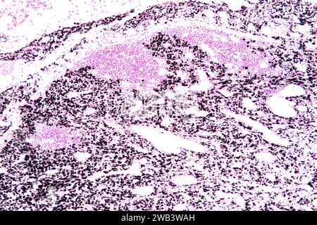 Human lymph node, light micrograph Stock Photo - Alamy