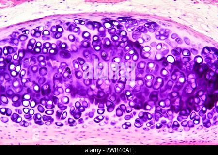 Human hyaline cartilage. X125 at 10 cm wide. Stock Photo