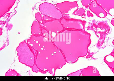 Human thyroid gland section showing colloid and follicular cells. X125 ...