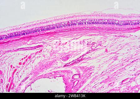 Human eye section showing retina with rods and cones, choroid and connective tissue with blood vessels. X75 at 10 cm wide. Stock Photo