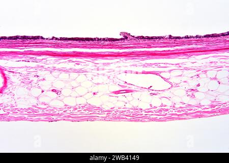 Human gallbladder wall section showing from up to down: simple columnar epithelium, lamina propria, smooth muscle fibers and connective tissue. X75 at Stock Photo