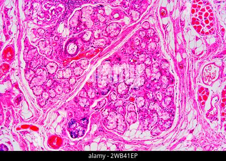 Parotid gland is the bigger salivary gland. We can see mucous gland ...