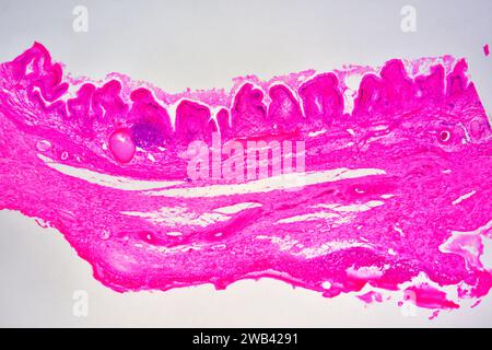 Gallbladder wall showing columnar epithelium with mucosal folds, connective tissue and smooth muscle fibers. Photomicrograph X30 at 10cm wide. Stock Photo