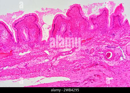 Gallbladder wall showing columnar epithelium with mucosal foldsi, connective tissue and smooth muscle fibers. Photomicrograph X30 at 10cm wide. Stock Photo