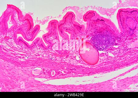 Gallbladder wall showing columnar epithelium with mucosal folds, connective tissue, blood vessels and smooth muscle fibers. Photomicrograph X75 at 10 Stock Photo