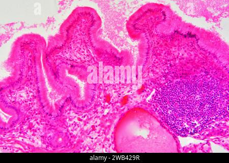 Gallbladder wall showing columnar epithelium with mucosal folds, connective tissue, blood vessels and smooth muscle fibers. Photomicrograph X150 at 10 Stock Photo