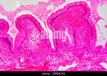 Gallbladder wall showing columnar epithelium with mucosal folds, connective tissue and smooth muscle fibers. Photomicrograph X150 at 10cm wide. Stock Photo