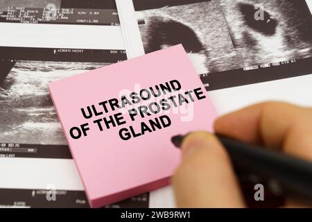 Medical concept. On the ultrasound pictures there are stickers that say - Ultrasound of the prostate gland Stock Photo