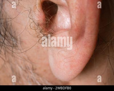 Remove ear hair hi res stock photography and images Alamy