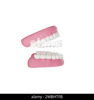 High-quality image of an invisible, clear plastic aligner for upper teeth, with 3D jaw model Stock Photo