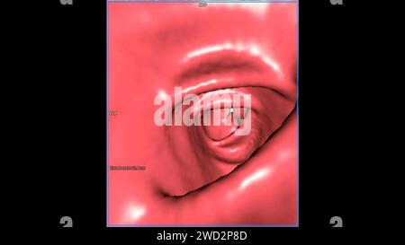 CT colonography , This imaging technique is often employed for colorectal cancer screening, providing detailed images of the colon's interior 3D rende Stock Photo