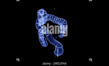 CT colonography , This imaging technique is often employed for colorectal cancer screening, providing detailed images of the colon's interior 3D rende Stock Photo