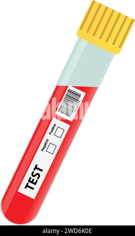 Blood Test Tube with blood, Medical Test blood sample, test result Stock Vector