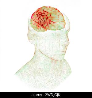 Memory lapses, forgetting things, degenerative disease. Brain problems. Parkinson and alzheimer desease. Mental health. Stroke, synapses and neurons Stock Photo