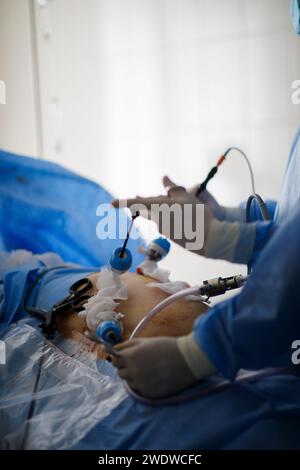 hands of doctors performing laparoscopy operations. High quality photo Stock Photo