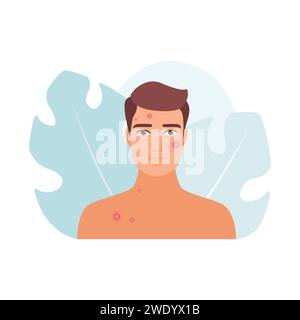 Sad worried man with acne problem and red pimples on face vector illustration Stock Vector