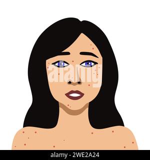 Vector image of a portrait young woman with acne minimalistic illustration Stock Vector