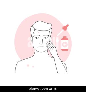 Sad man with acne, inflammation on face skin applying serum with cotton pad vector illustration Stock Vector