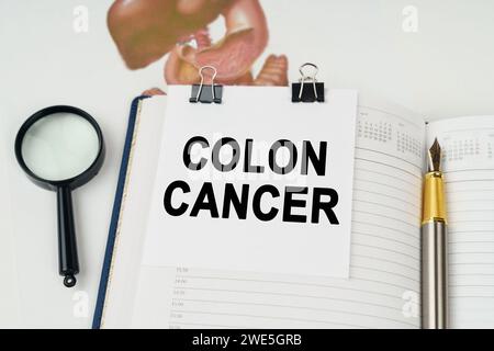 Medical concept. On the table there is a magnifying glass and a notepad with the inscription - Colon cancer Stock Photo