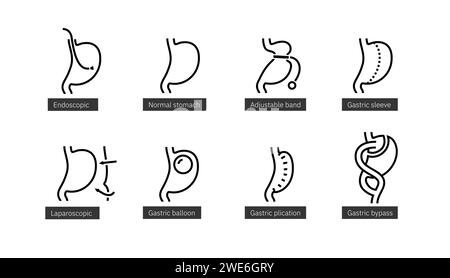 Set of line icons of bariatric surgery methods. Endoscopy and laparoscopy operations on stomach for weight loss. Stock Vector