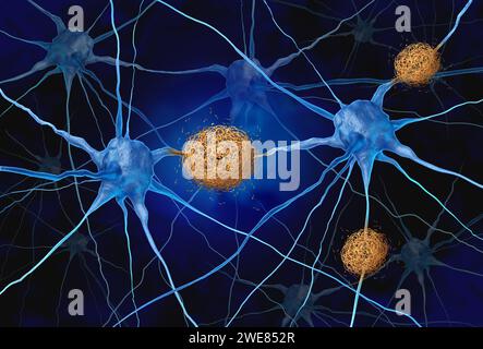 Amyloid Plaques concept as abnormal clusters of protein fragments that accumulate between nerve cells in the brain resulting in degenerative disease Stock Photo