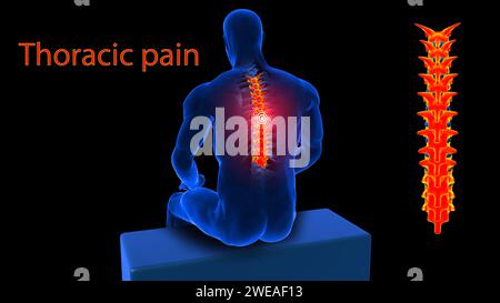 Thoracic spine T 6 bone anatomy for medical concept 3D Illustration ...