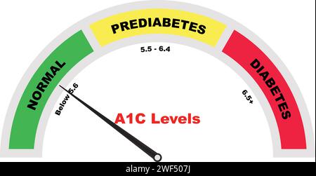 A1C Test Meter, Diagnosing Prediabetes, Hemoglobin Blood Test, Tube with blood, Medical Test blood sample, test result negative Stock Vector